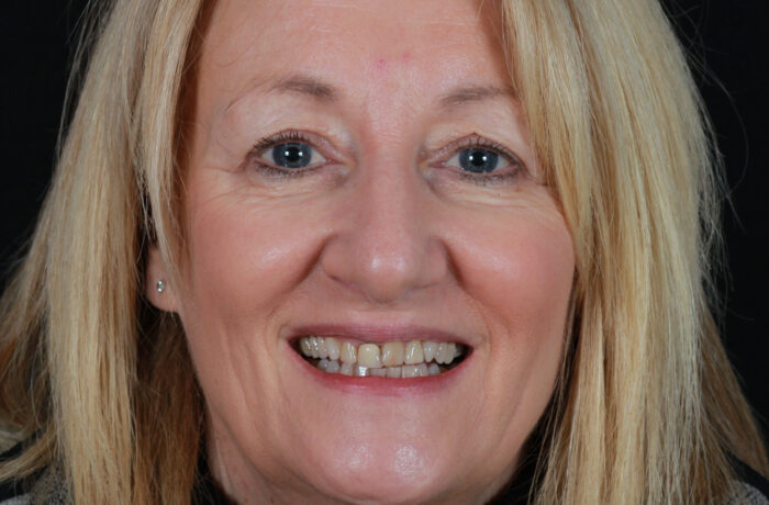 Before - Cheadle Hulme Dental
