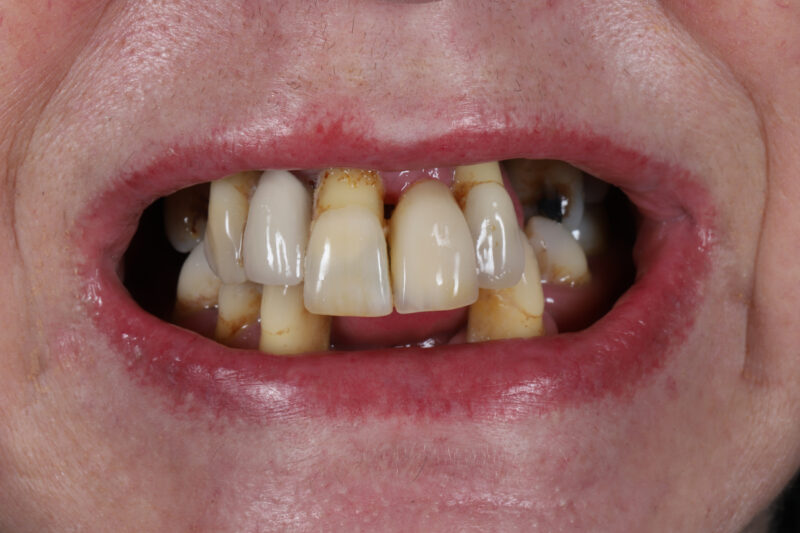 Before - Cheadle Hulme Dental