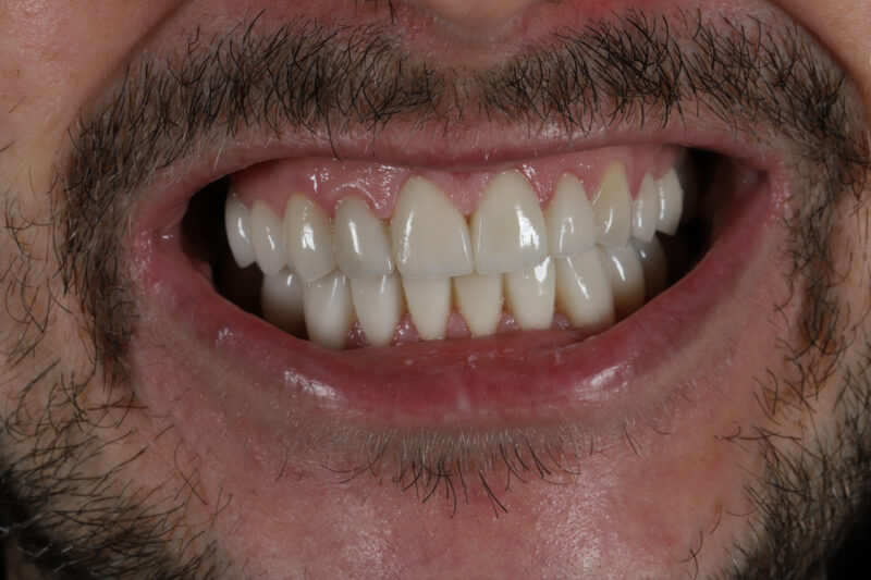 After - Cheadle Hulme Dental