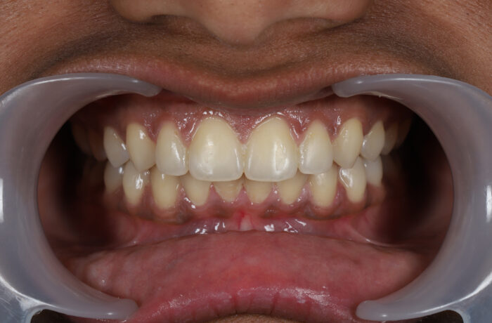 After - Cheadle Hulme Dental