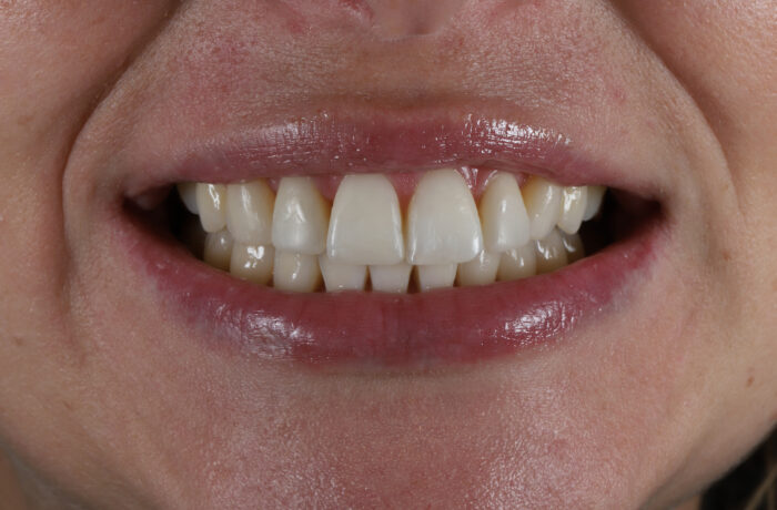 After - Cheadle Hulme Dental