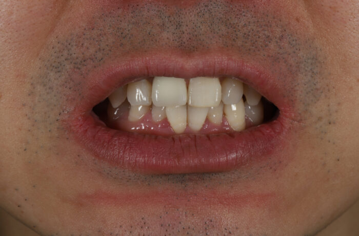 After - Cheadle Hulme Dental