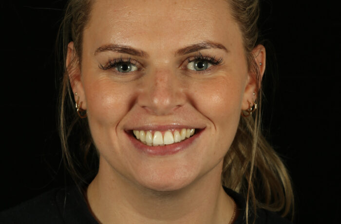 After - Cheadle Hulme Dental