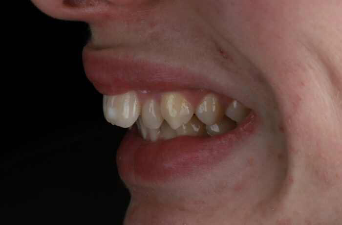 Before - Cheadle Hulme Dental