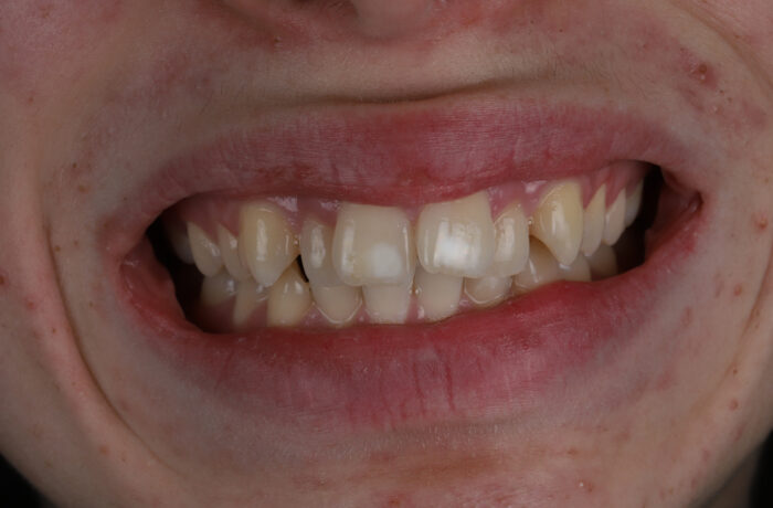 Before - Cheadle Hulme Dental