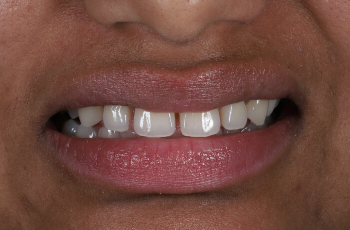 Before - Cheadle Hulme Dental