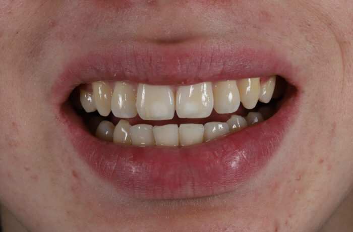 After - Cheadle Hulme Dental