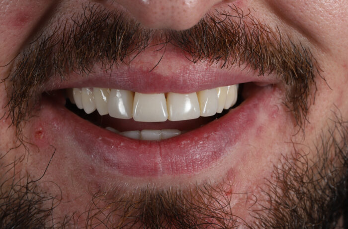 After - Cheadle Hulme Dental