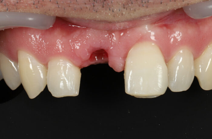 Before - Cheadle Hulme Dental