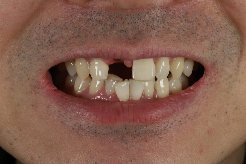 Before - Cheadle Hulme Dental