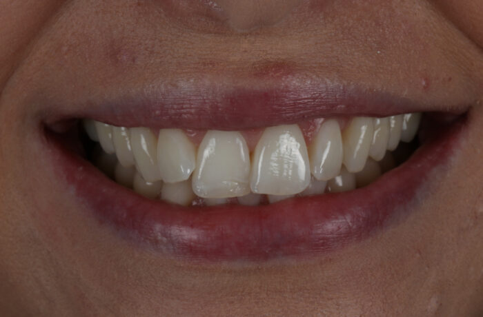 Before - Cheadle Hulme Dental