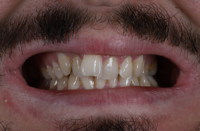 Before - Cheadle Hulme Dental