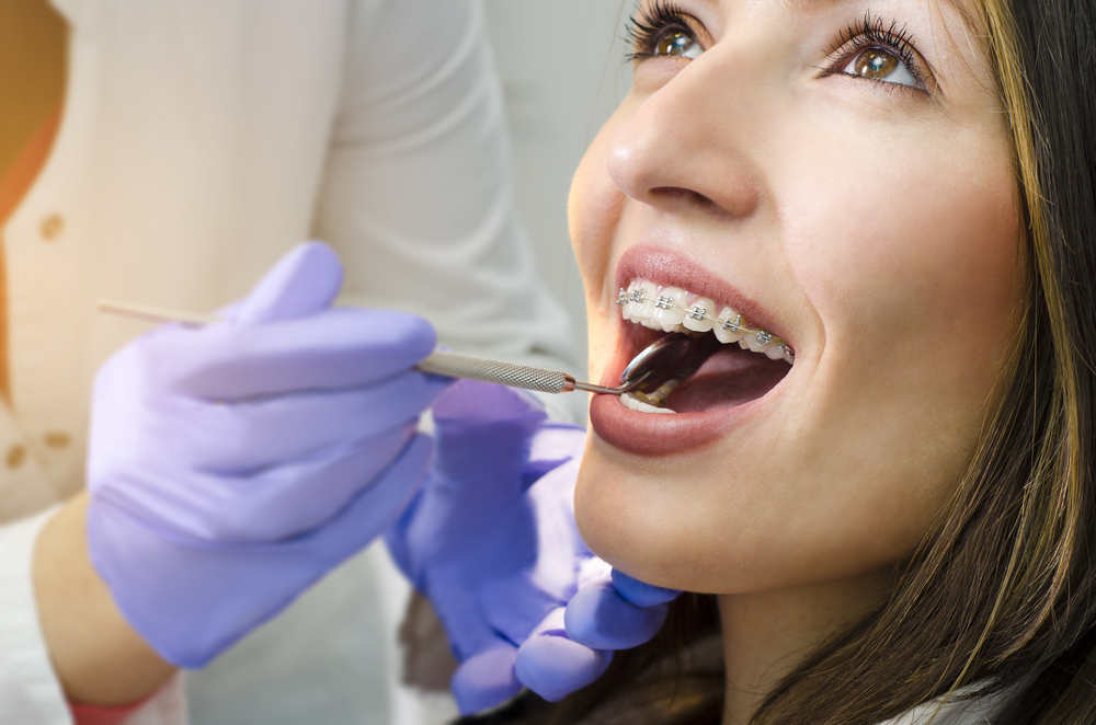 Braces in Manchester