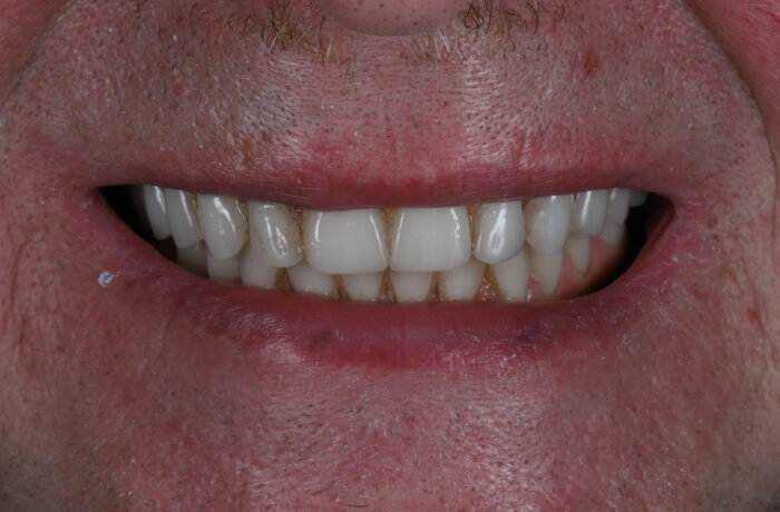 After - Cheadle Hulme Dental