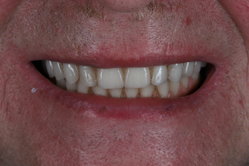 After - Cheadle Hulme Dental