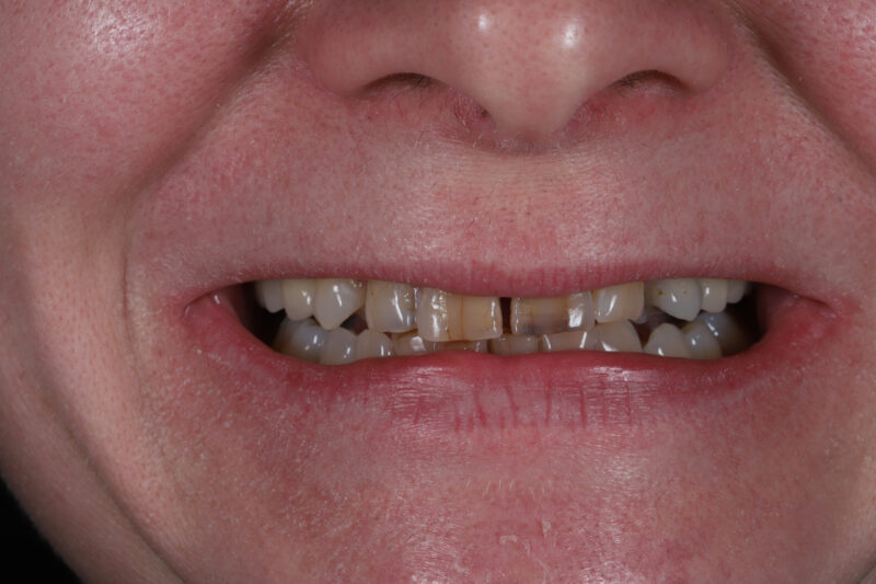 Before - Cheadle Hulme Dental