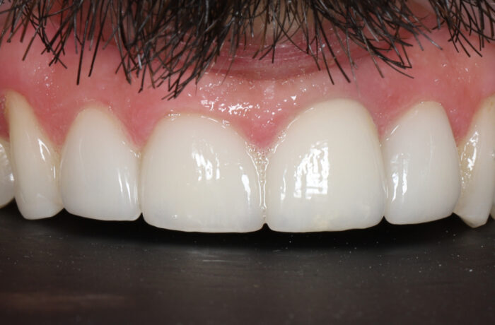 After - Cheadle Hulme Dental