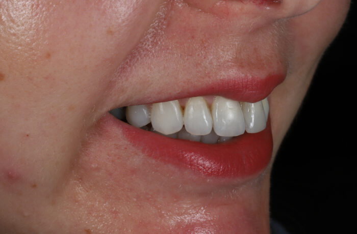 After - Cheadle Hulme Dental