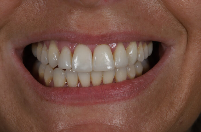 After - Cheadle Hulme Dental