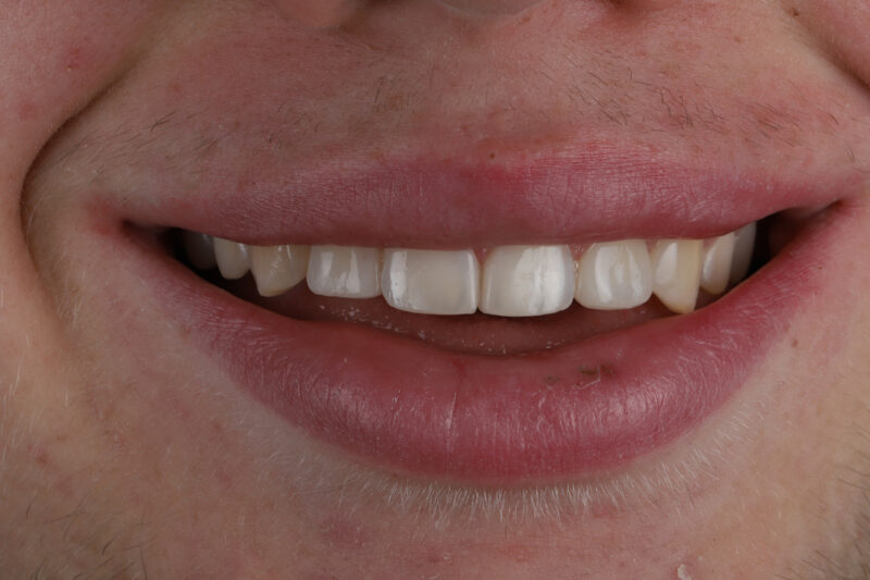 After - Cheadle Hulme Dental