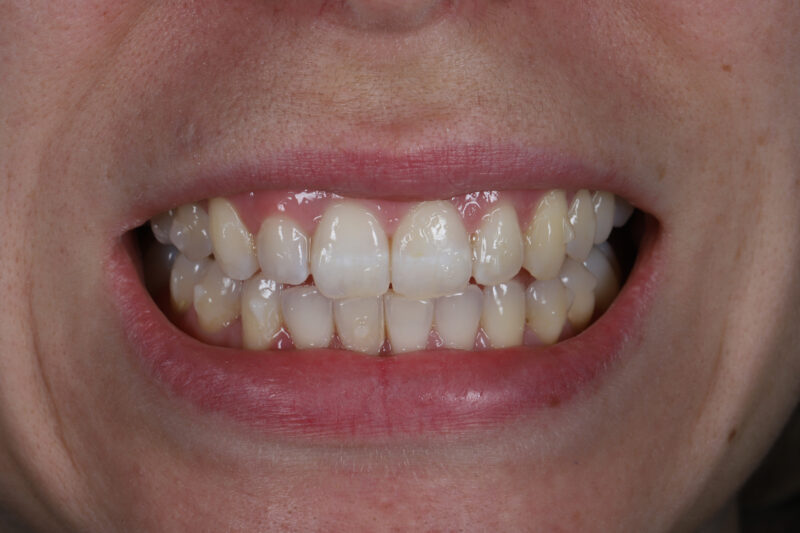 After - Cheadle Hulme Dental