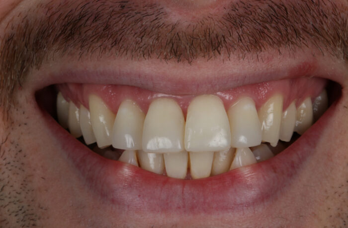 After - Cheadle Hulme Dental