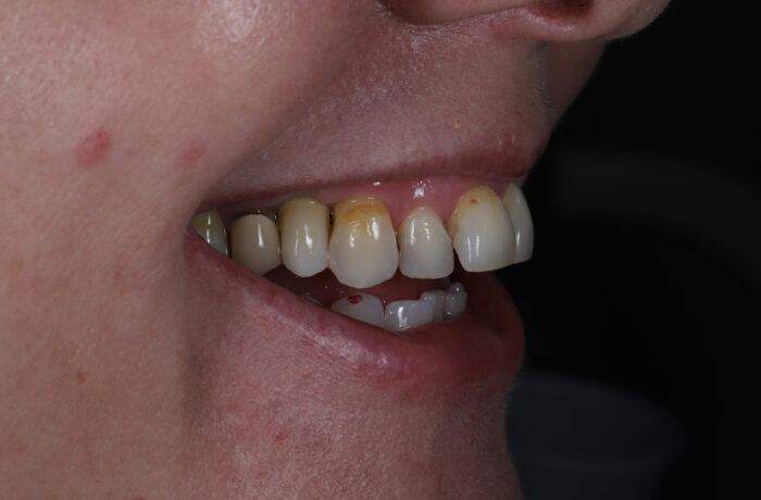 After - Cheadle Hulme Dental