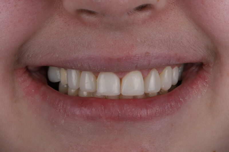 After - Cheadle Hulme Dental