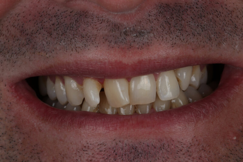 Before - Cheadle Hulme Dental