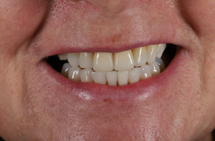 After - Cheadle Hulme Dental