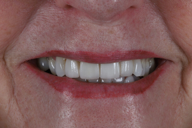 After - Cheadle Hulme Dental