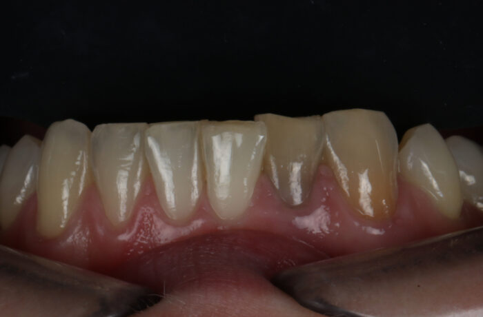 Before - Cheadle Hulme Dental