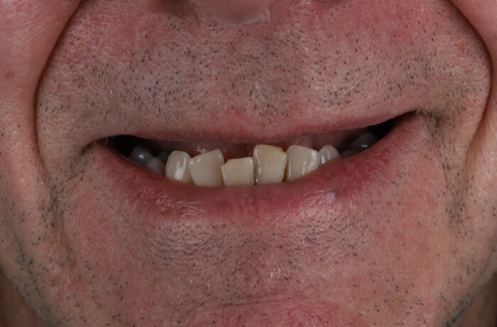 Before - Cheadle Hulme Dental