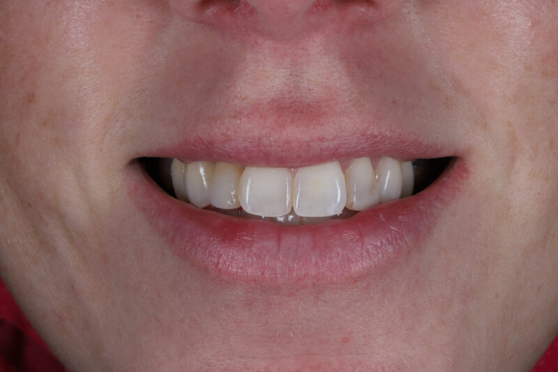 Before - Cheadle Hulme Dental