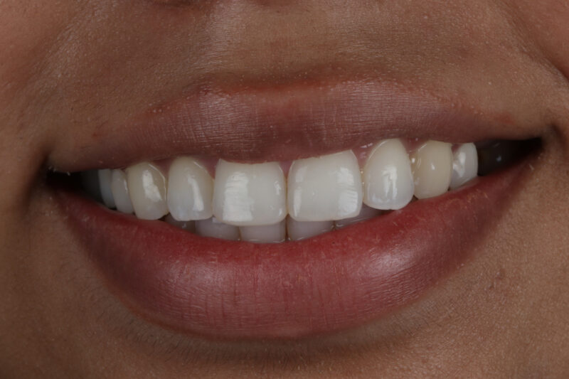 After - Cheadle Hulme Dental