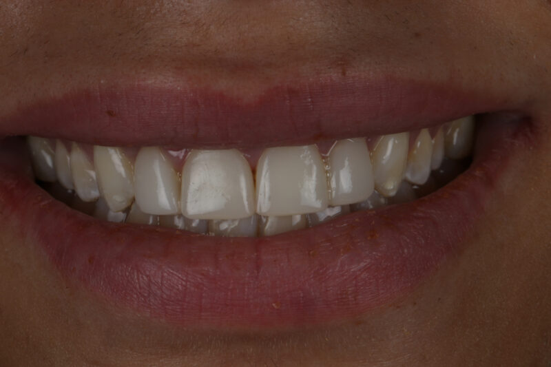 After - Cheadle Hulme Dental