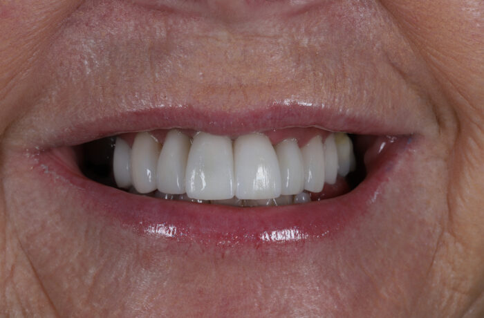 After - Cheadle Hulme Dental