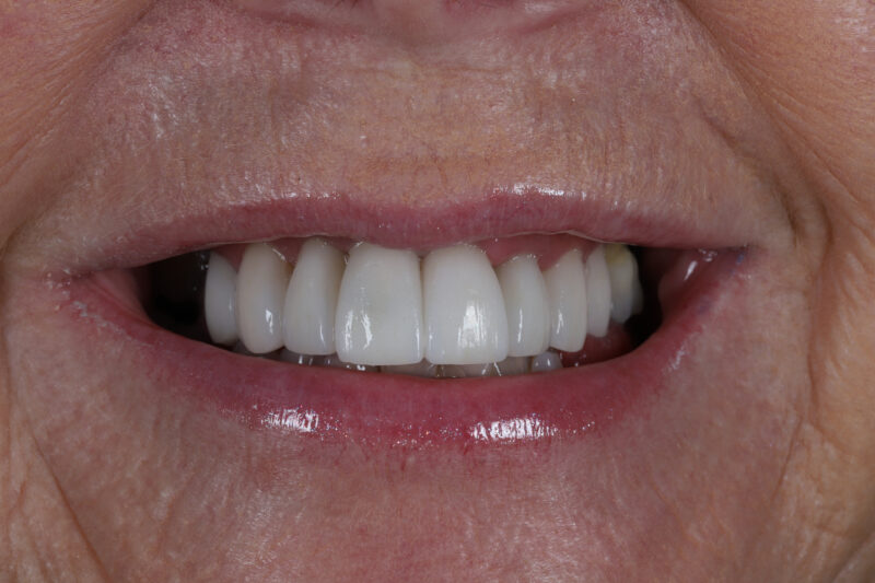 After - Cheadle Hulme Dental