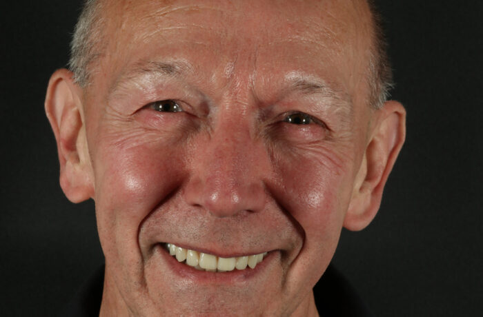 After - Cheadle Hulme Dental