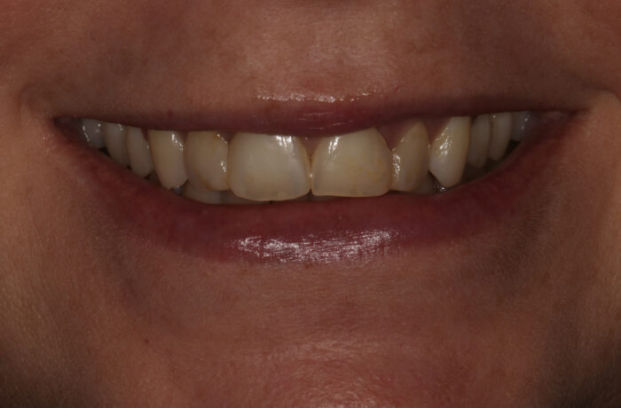 Before - Cheadle Hulme Dental