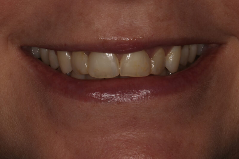 Before - Cheadle Hulme Dental