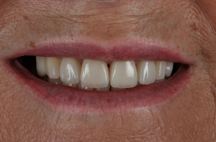 After - Cheadle Hulme Dental