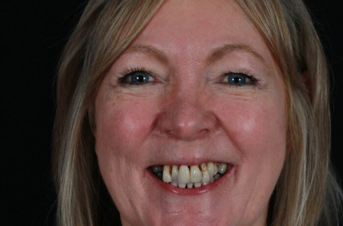 Before - Cheadle Hulme Dental