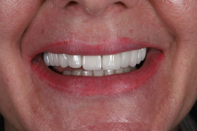 After - Cheadle Hulme Dental