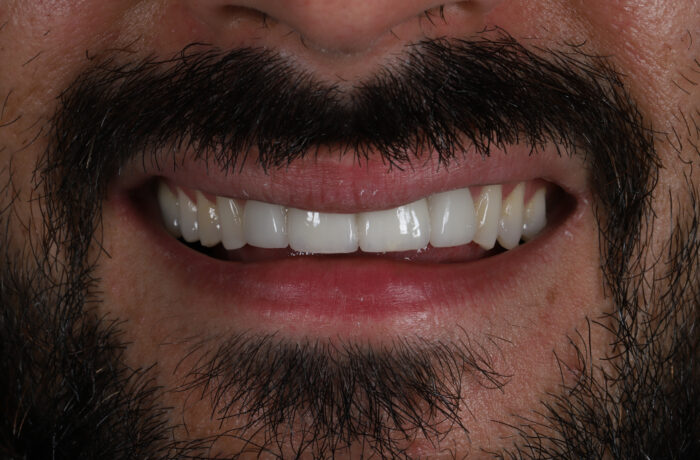 After - Cheadle Hulme Dental