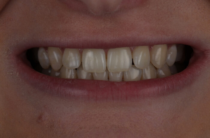 Before - Cheadle Hulme Dental