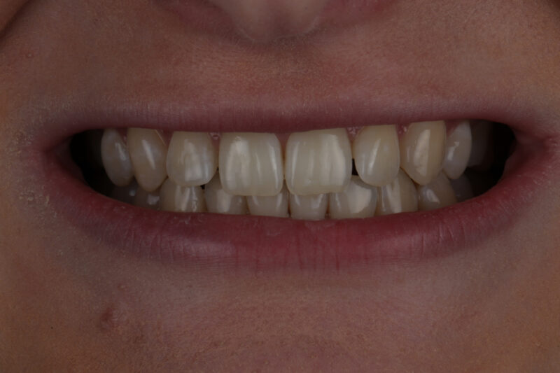 Before - Cheadle Hulme Dental