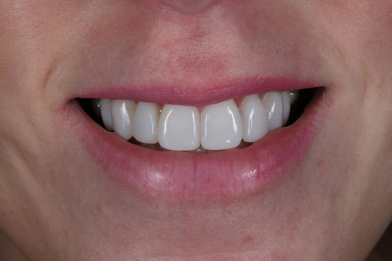 After - Cheadle Hulme Dental