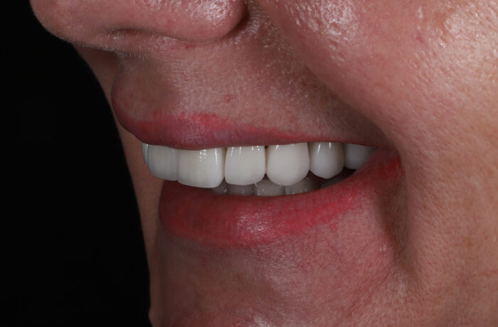 After - Cheadle Hulme Dental