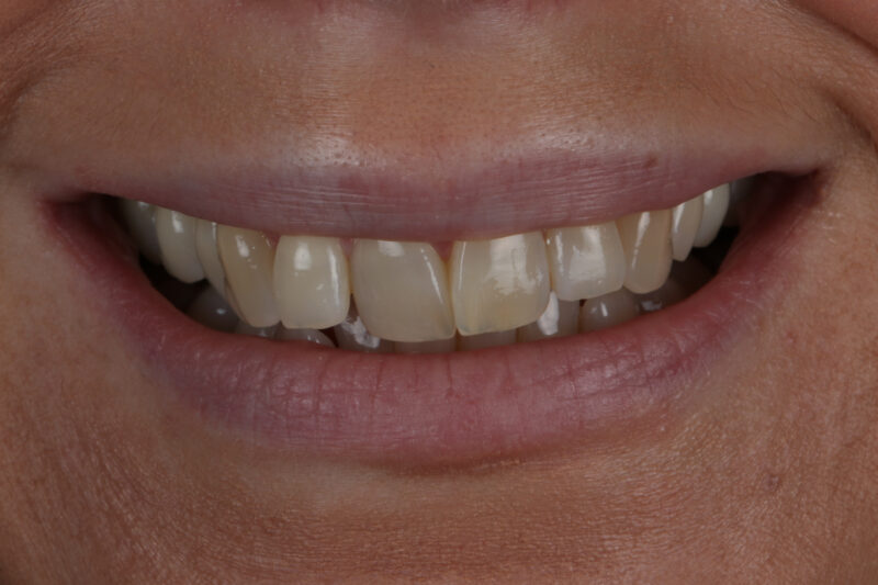 Before - Cheadle Hulme Dental